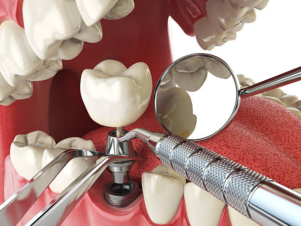 Best Emergency Treatment for Toothache in Walsenburg, CO